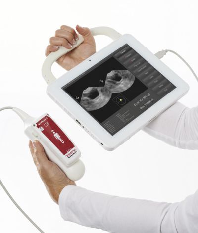 bladder scanner bladder scanner