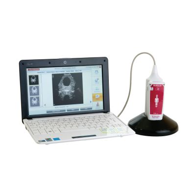 bladder scanner portable bladder scanner portable