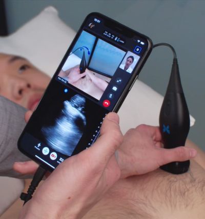 bladderscanner bladderscanner