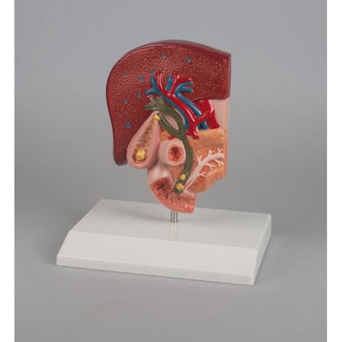 calculating convenience store profit and loss