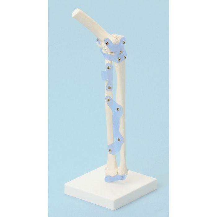 Articulation du coude avec 2011 Articulation du coude avec 2011