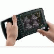 ECHOGRAPHE SUR BATTERIE WED 3100