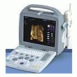 ECHOGRAPHE PORTABLE AVEC DOPPLER FONCTION PANORAMIQUE SRT