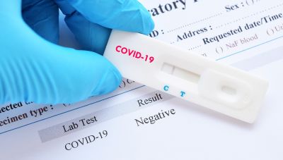 Test rapide coronavirus