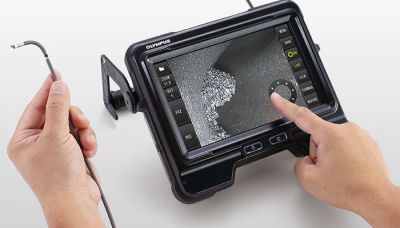 Combien coûte un endoscope ?