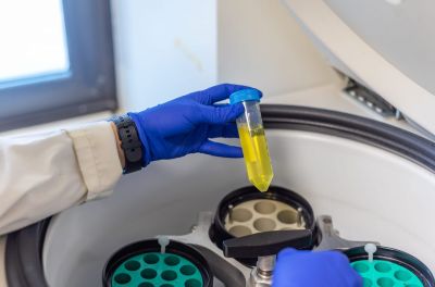 centrifugation centrifugation