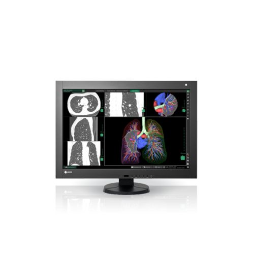 Écran Eizo RadiForce RX440 - 4MP - 76 cm (29.8