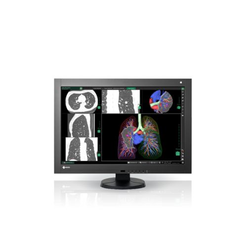 Ecran eizo radiforce rx440_0