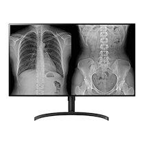 LG 32HL512D-B écran plat de PC 80 cm (31.5