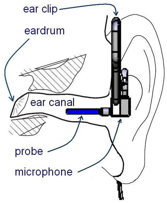 Dosimetre avec microphone dans conduit auditif ("mire")_0