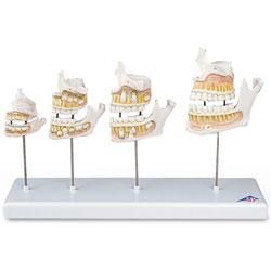 MAQUETTE DE DÉVELOPPEMENT DE LA DENTITION