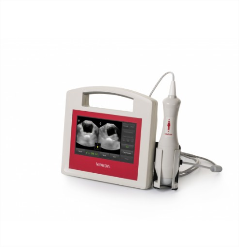 Bladder scanner vitascan dp portable sans pied - bla013_0