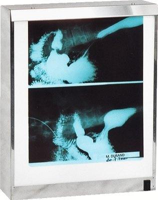 LE NÉGATOSCOPE STANDARD 1 PLAGE 60 X 43 CM 54 W - MANUTAN COLLECTIVITÉS