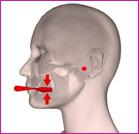 Systeme de traitement d'occlusion - « ora » correcteur de posture_0