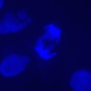 Set de filtres fluorescence dapi