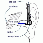 Dosimetre avec microphone dans conduit auditif (&quot;mire&quot;)