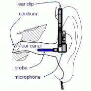 Dosimetre avec microphone dans conduit auditif ("mire")