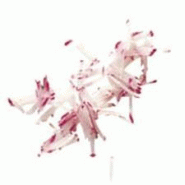 Disque Bâtonnets & Julienne 2x2 mm - Ø 190 mm | Robot Coupe - W | Robotcoupe - 28051