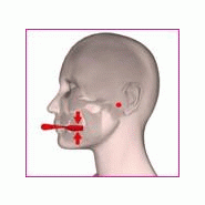 Systeme de traitement d'occlusion - « ora » correcteur de posture