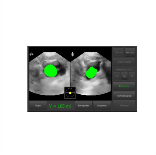 Bladder scanner VitaScan DP avec pied - Bla012 - mesure du volume de la vessie, imprimante intégrée, sonde 3D_2