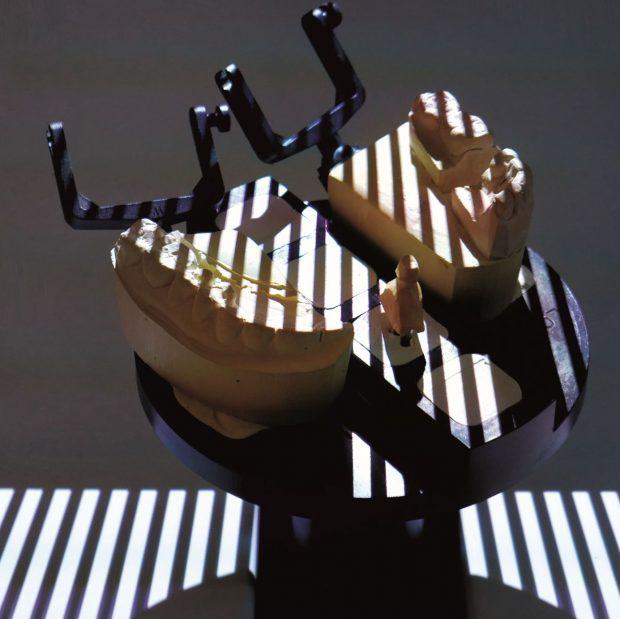 Scanner 3D NeWay - Lumière structurée - Open Technologies - Projets dentaires précis_1