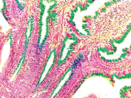 Caméra numérique pour microscope avec résolution 2048 × 1532 pixels