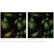 Objectifs : série cfi plan apochromat lambda d_1