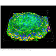 Lentille d'objectif à immersion en silicone - haute résolution pour imagerie biologique_1