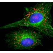 Caméra sCMOS Leica DFC9000 - pour microscope - imagerie en fluorescence haute performance_1