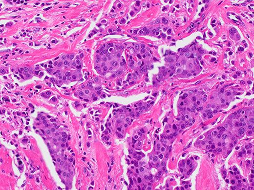 Caméra CMOS DP28 Olympus - Ultra-haute définition 4K - 8,9 MP - Microscopie et enseignement_2