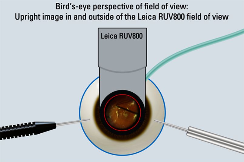 Ruv800 - loupe binoculaire - leica - avec inverseur intégré_2