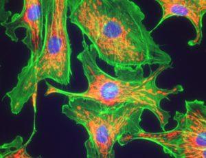 Microscope Nikon Eclipse Ci - Fluorescence avec système optique CFI60 et options LED ou mercure_2