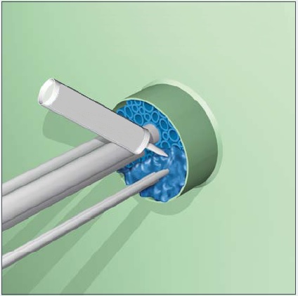 Obturateur de réseaux et de fourreaux - etanch-cable_2