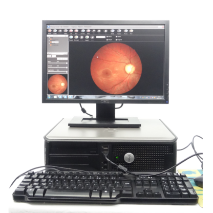 Nidek Retinographe AFC-210 - Observation précise de l'œil avec écran LCD TFT 5,7 pouces et caméra CCD haute résolution_2