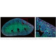 Objectifs : série cfi plan apochromat lambda d_2