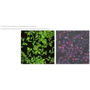 Objectifs - Série S Plan Fluor LWD - haute résolution et grand champ de vision pour microscopes biologiques_2