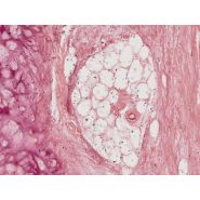 Caméra Olympus LC30 avec interface USB 2.0 et monture en C