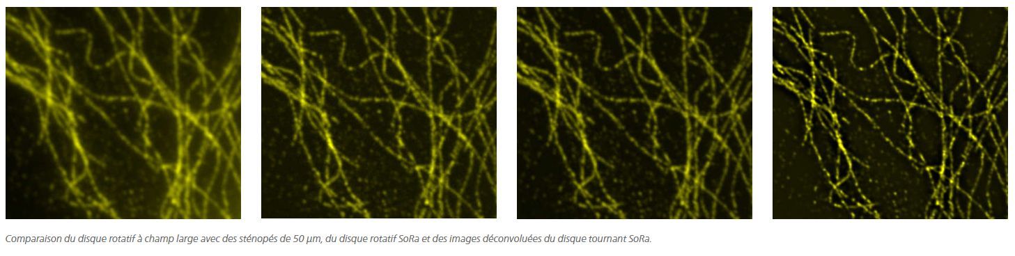 CSU-W1 SoRa : système confocal à balayage de disque tournant Yokogawa - résolution XY 120 nm - super-résolution et configurations flexibles_3