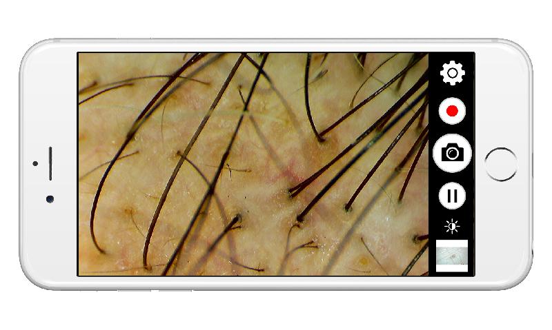 De337t - Trichoscope Wifi HD Polarisant - Firefly - Haute Définition - Grossissement Optique et Numérique_3