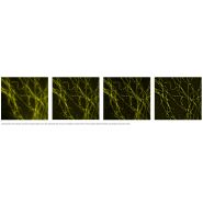 CSU-W1 SoRa : système confocal à balayage de disque tournant Yokogawa - résolution XY 120 nm - super-résolution et configurations flexibles_3