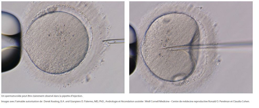 Microscope Nikon Eclipse Ti2-U IVF avec objectifs compatibles NAMC et observation des fuseaux