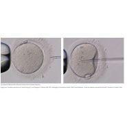 Microscope avancé Nikon Eclipse Ti2-U IVF pour ICSI et observation des échantillons transparents