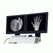 Arceau chirurgical SD30C - C-arm haute performance pour orthopédie, urologie - générateur RX 40 kHz_5